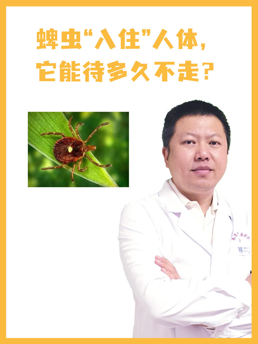 蜱虫“入住”人体，它能待多久不走？