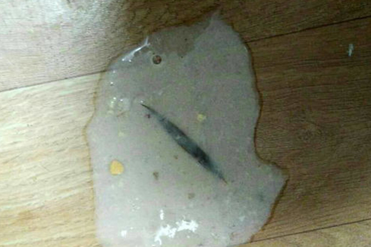 呕吐出白色胆汁图 呕吐出白色胆汁图