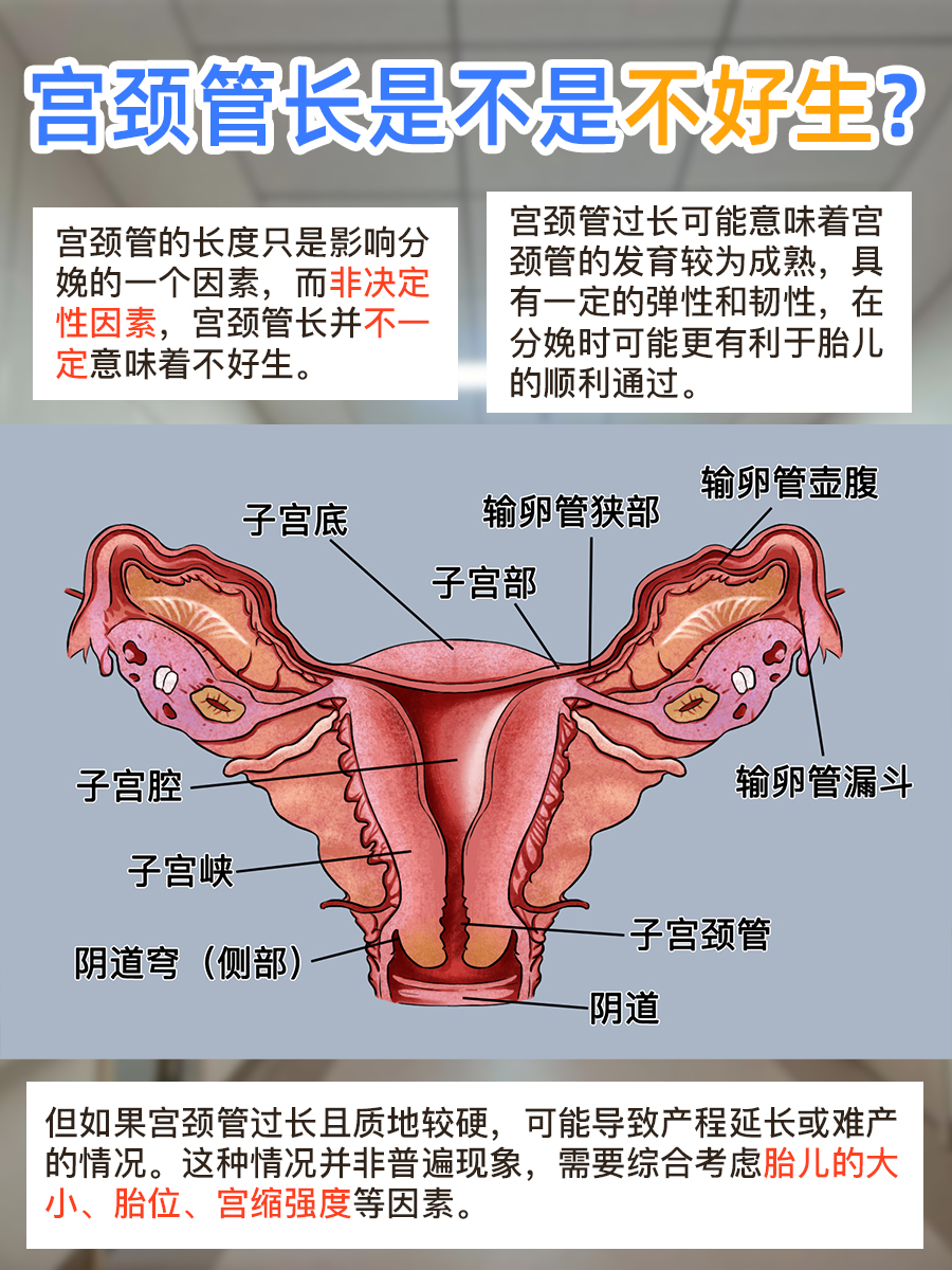 宫颈管长，分娩挑战会更大？速来了解