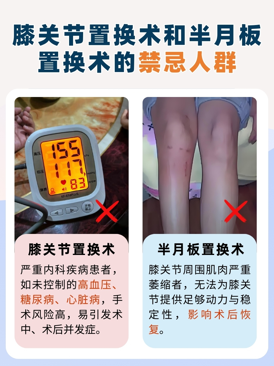 别混淆!膝关节置换和半月板置换不一样