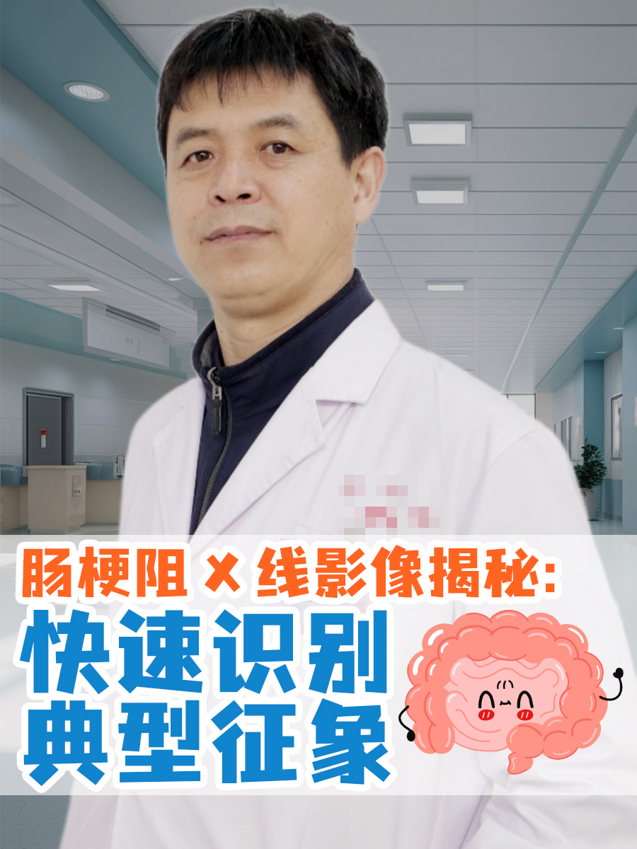 肠梗阻X线影像揭秘:快速识别典型征象