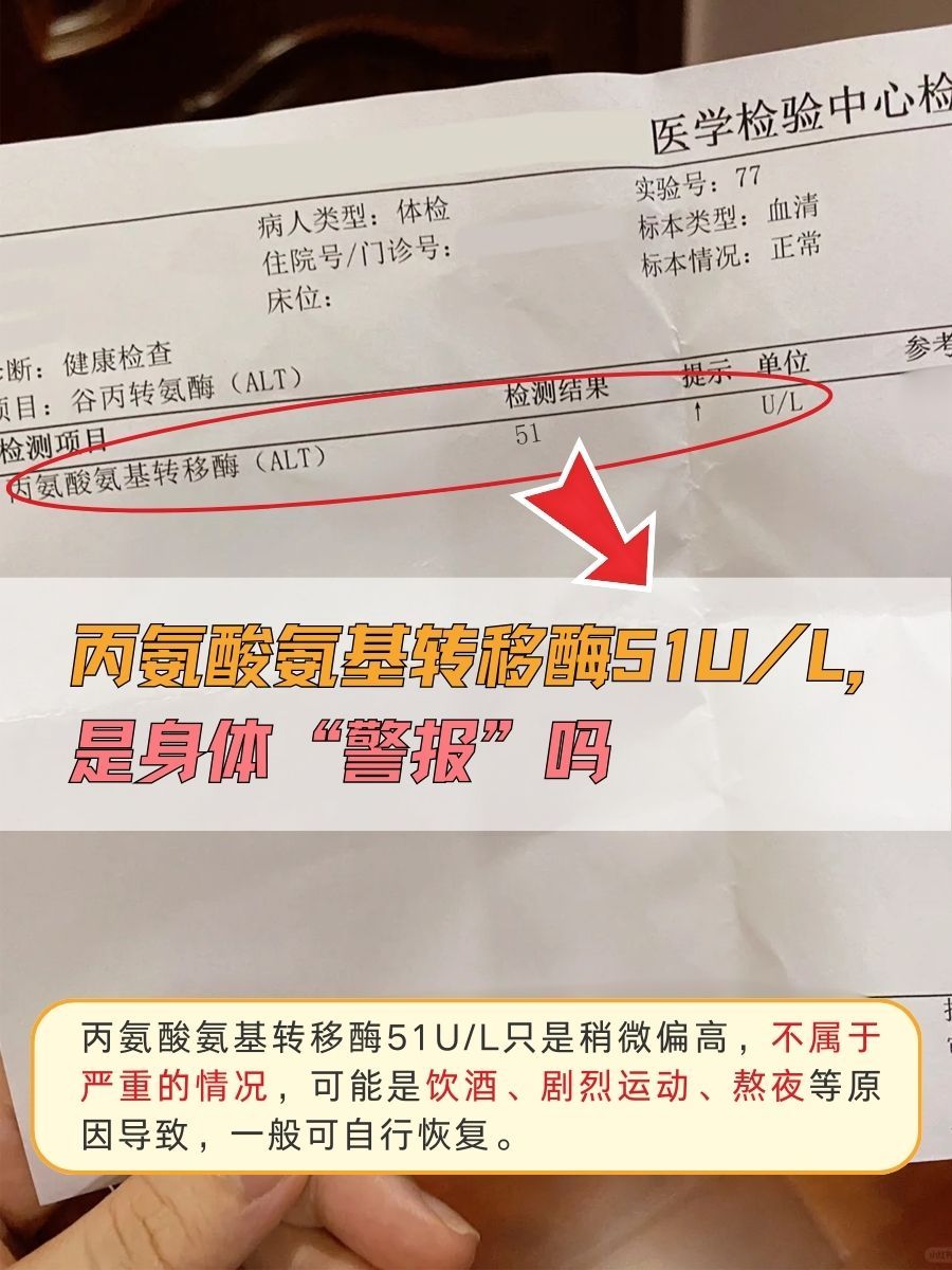 丙氨酸氨基转移酶51U/L，是身体“警报”吗