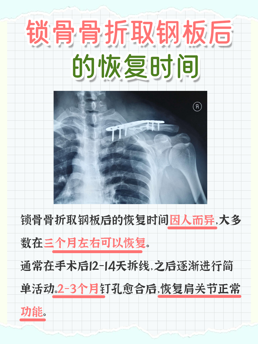 深度分析：锁骨骨折取钢板后多久恢复正常？