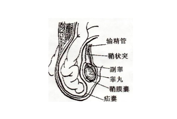睾丸蚯蚓状图片图片