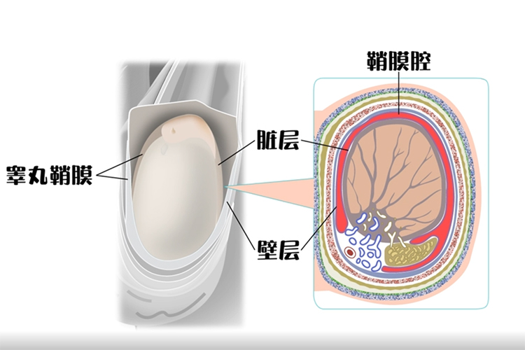 鞘膜腔位置图 鞘膜腔位置图