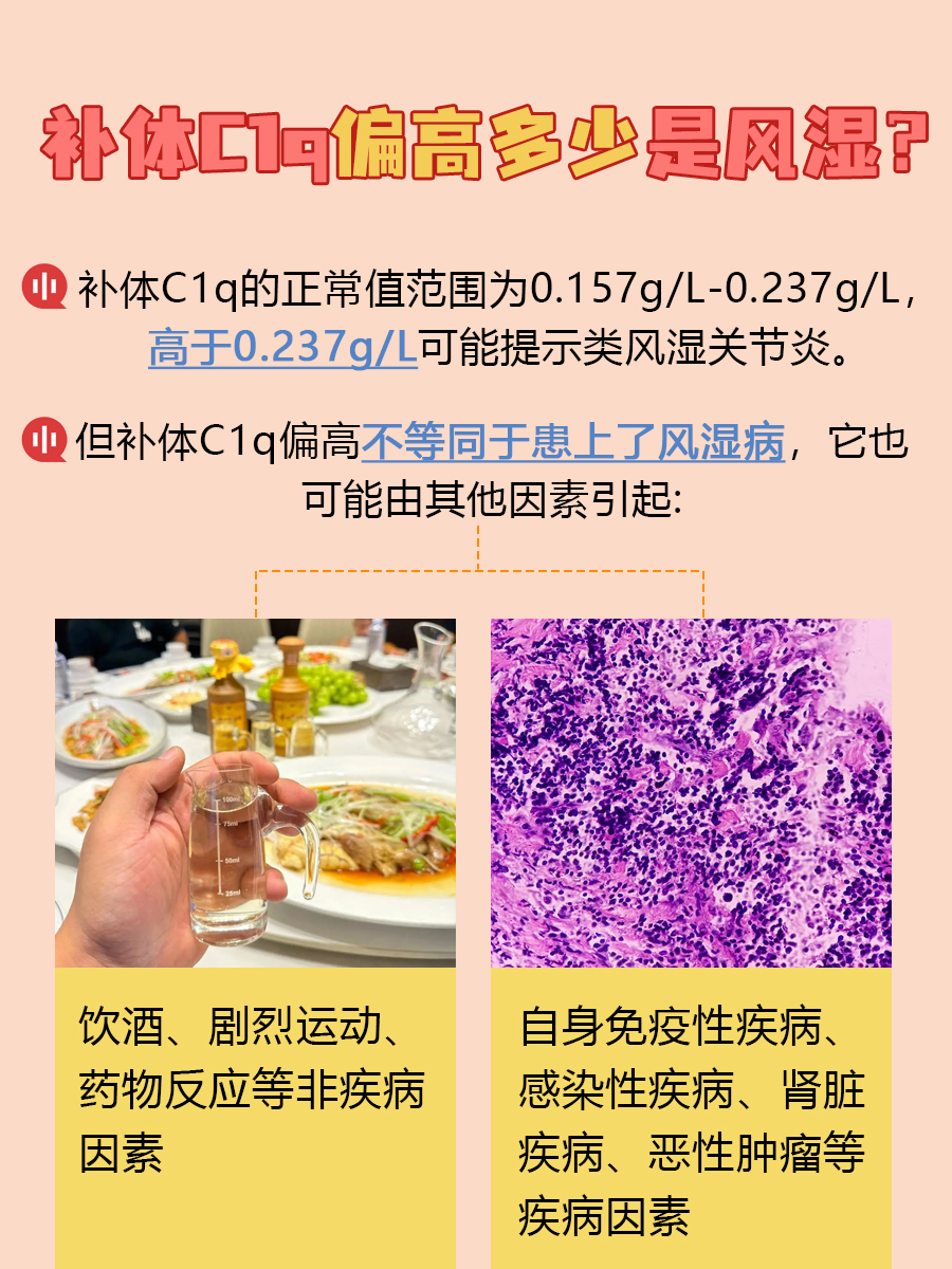 补体C1q偏高多少?小心风湿在敲门!