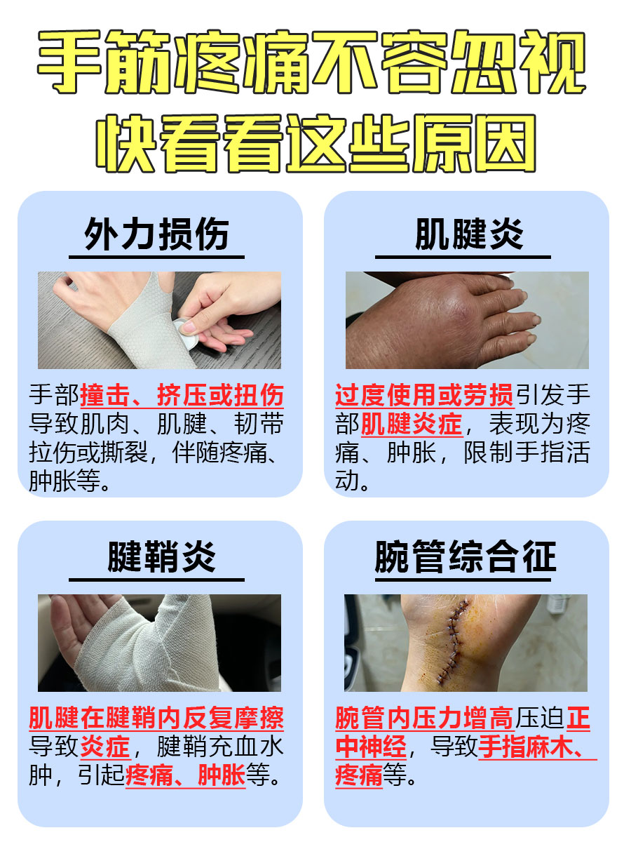 手筋疼痛？这些原因你可能不知道