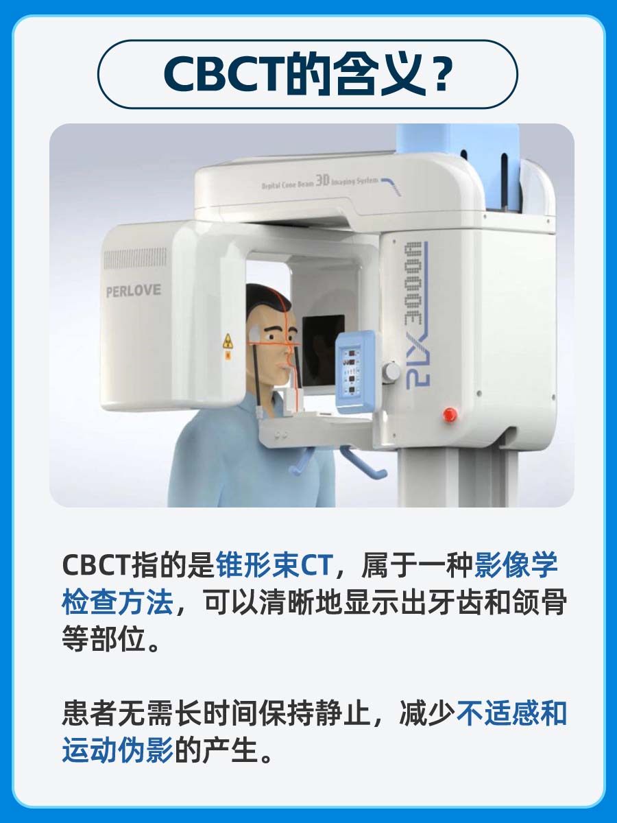 我来告诉你：CBCT是什么？