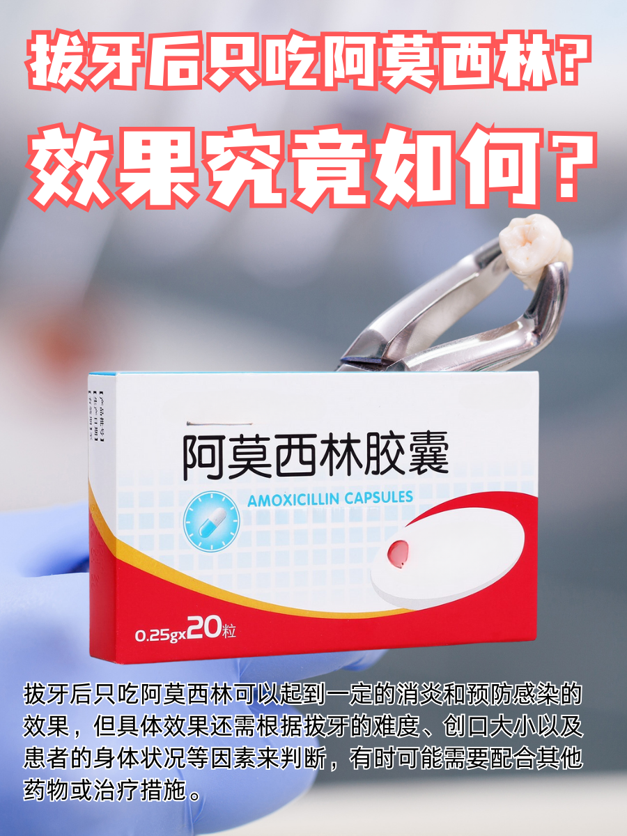 拔牙后只吃阿莫西林？效果究竟如何？