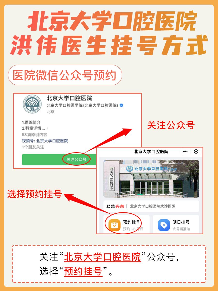 北京大学口腔医院洪伟医生怎么样？怎么挂号？