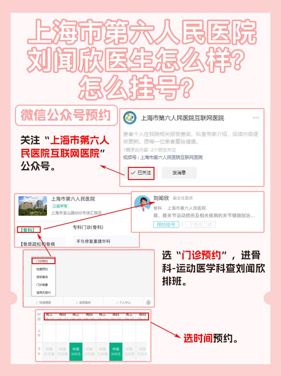 上海市第六人民医院刘闻欣医生怎么样?怎么挂号?