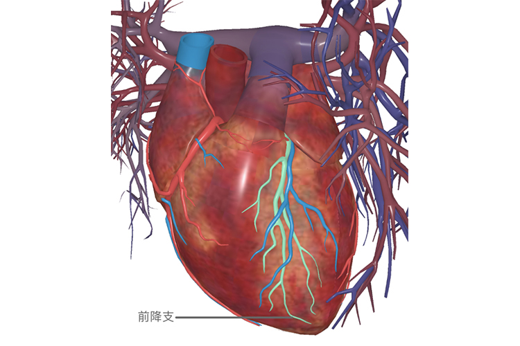 心脏前降支图