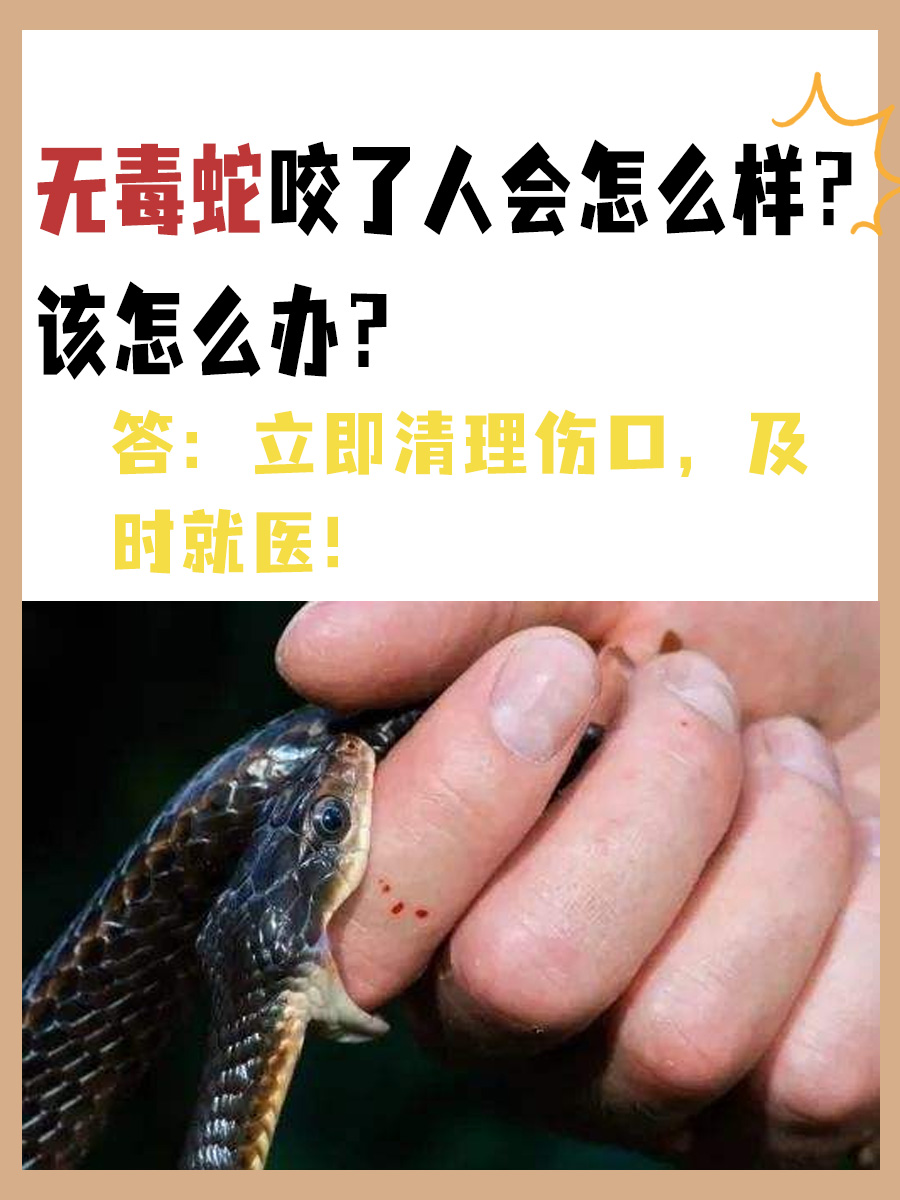 无毒蛇咬了人会怎么样？该怎么办？