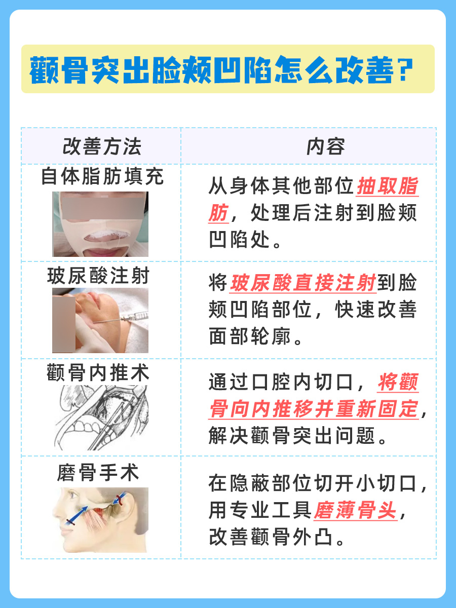 小课堂：颧骨突出？脸颊凹陷？医生教你如何做？