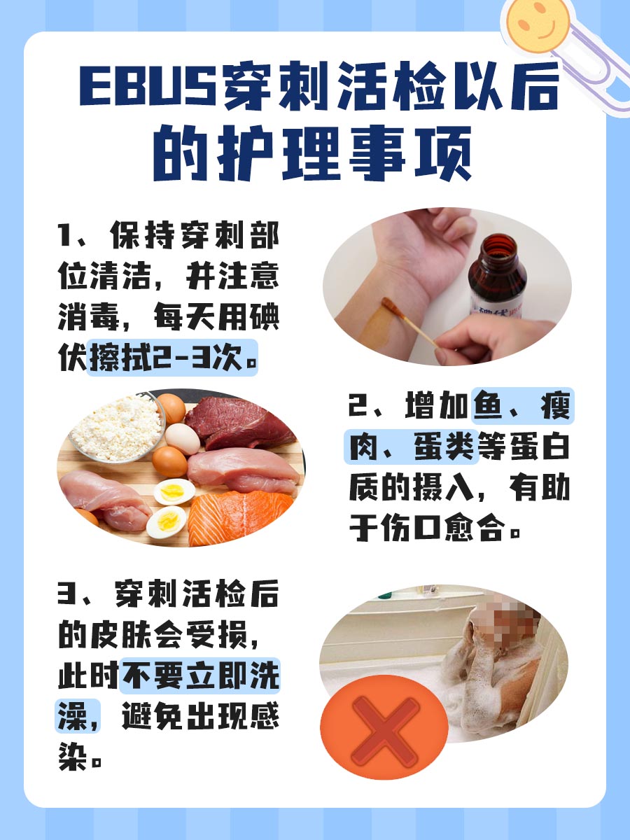EBUS穿刺活检：它的价格你了解吗？