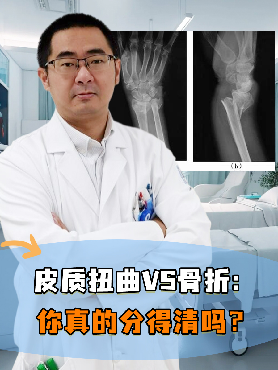 皮质扭曲VS骨折：你真的分得清吗？