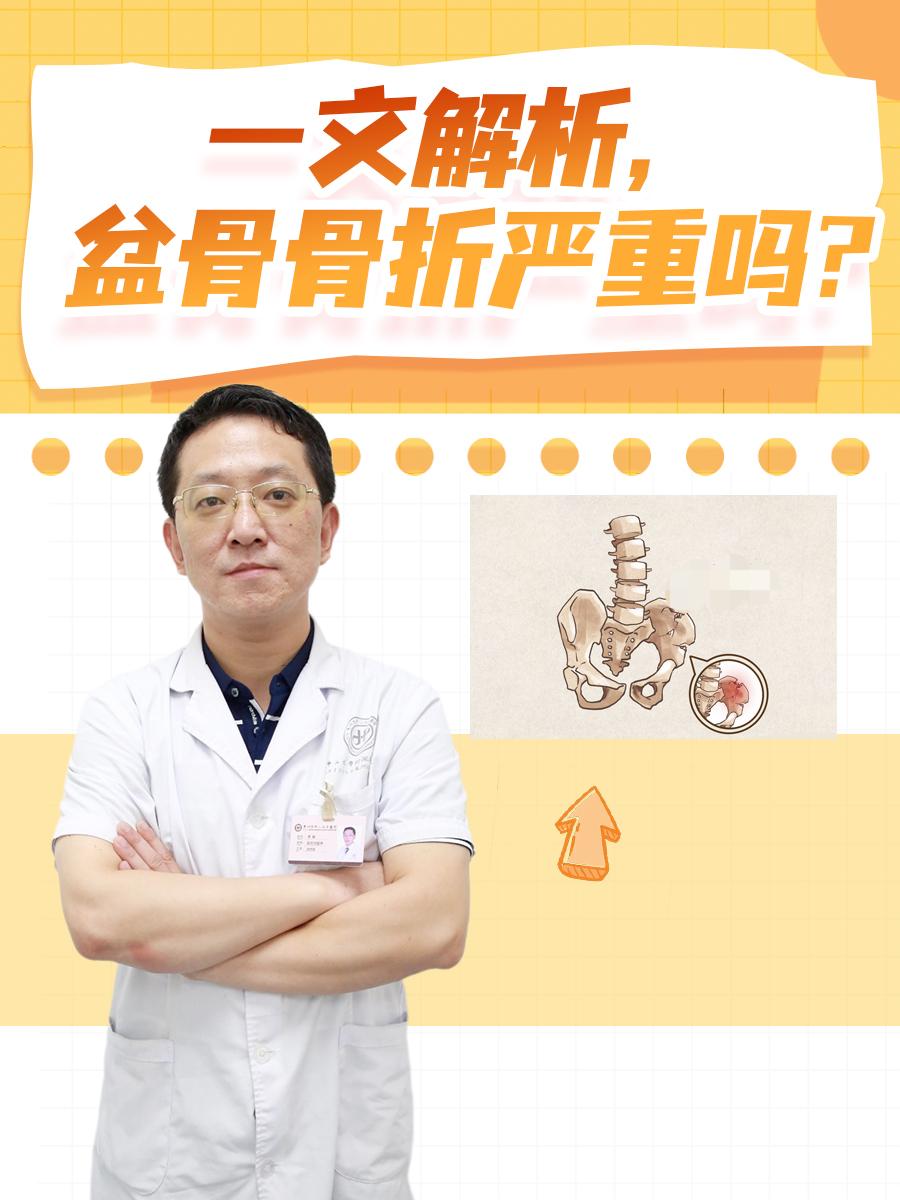 一文解析,盆骨骨折严重吗?