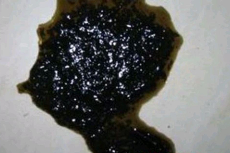 黑色柏油样便图