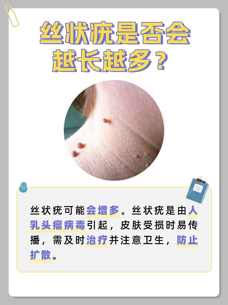 丝状疣是否会增多:揭秘疣体蔓延的真相!