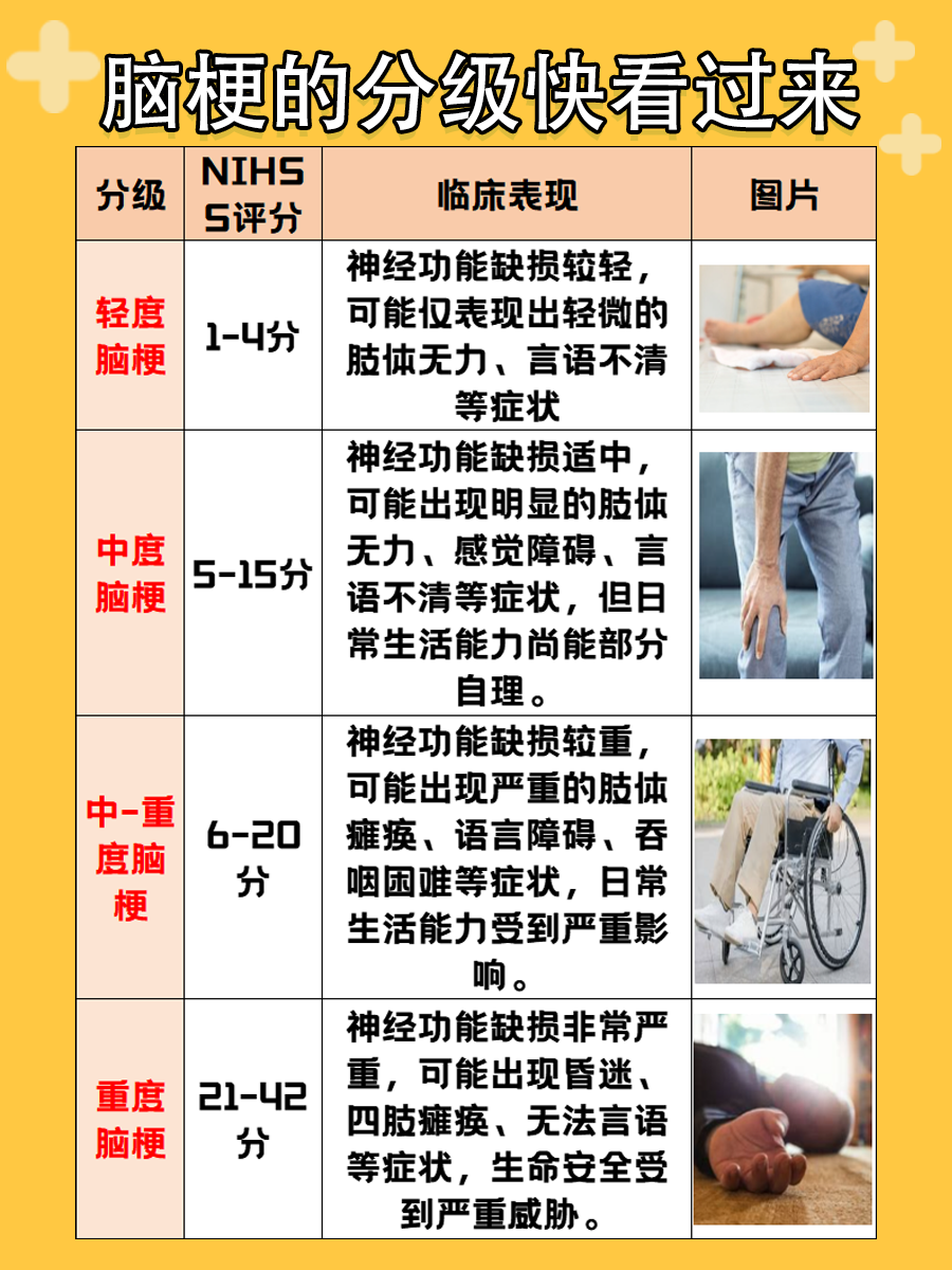 医生详解——脑梗死严重程度的分级