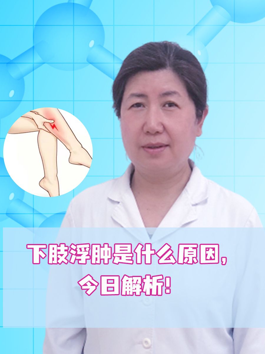 下肢浮肿是什么原因，今日解析！