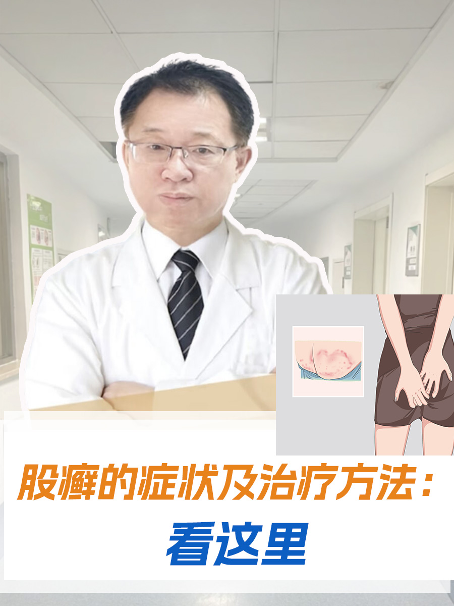 股癣的症状及治疗方法:看这里