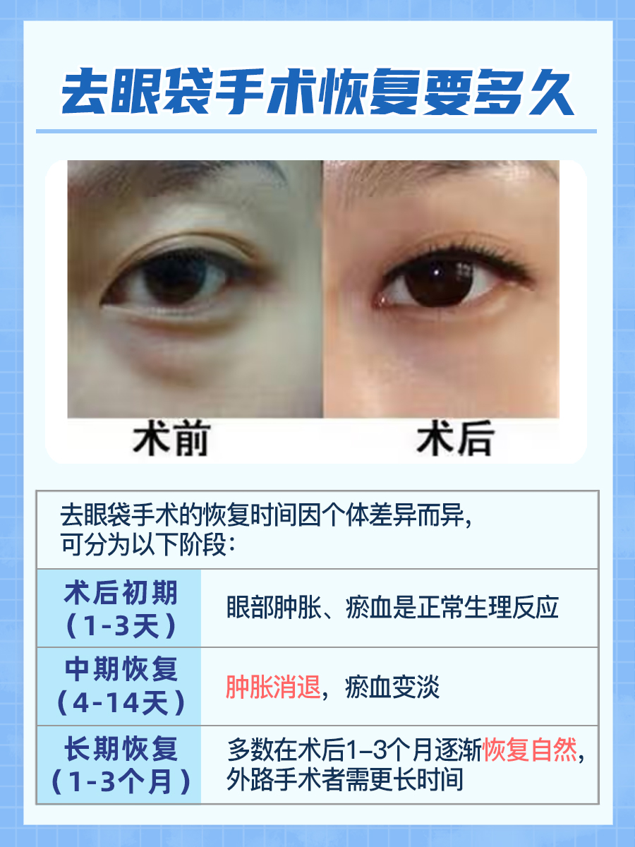 医生视角:去眼袋手术恢复时间全解析