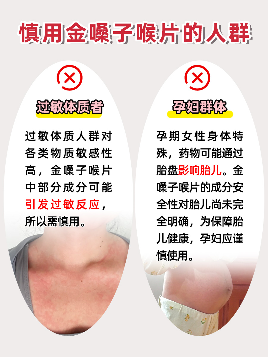 别蒙圈！金嗓子喉片是什么，能拯救你的嗓子吗