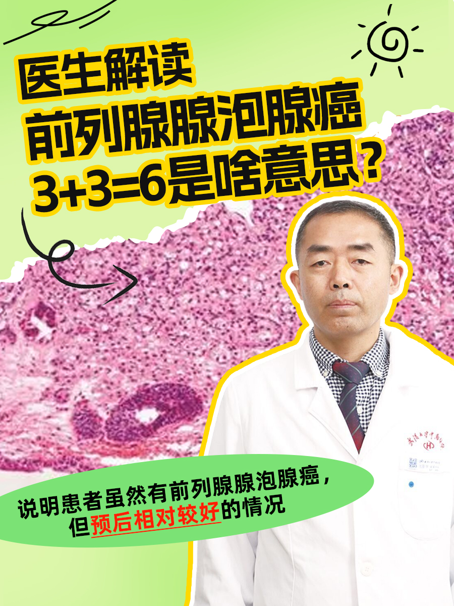医生解读：前列腺腺泡腺癌3+3=6是啥意思？