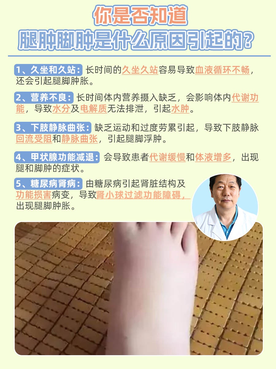 你是否知道：腿肿脚肿是什么原因引起的？