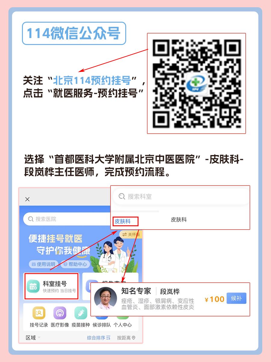 北京中医医院段岚桦医生怎么样？怎么挂号？