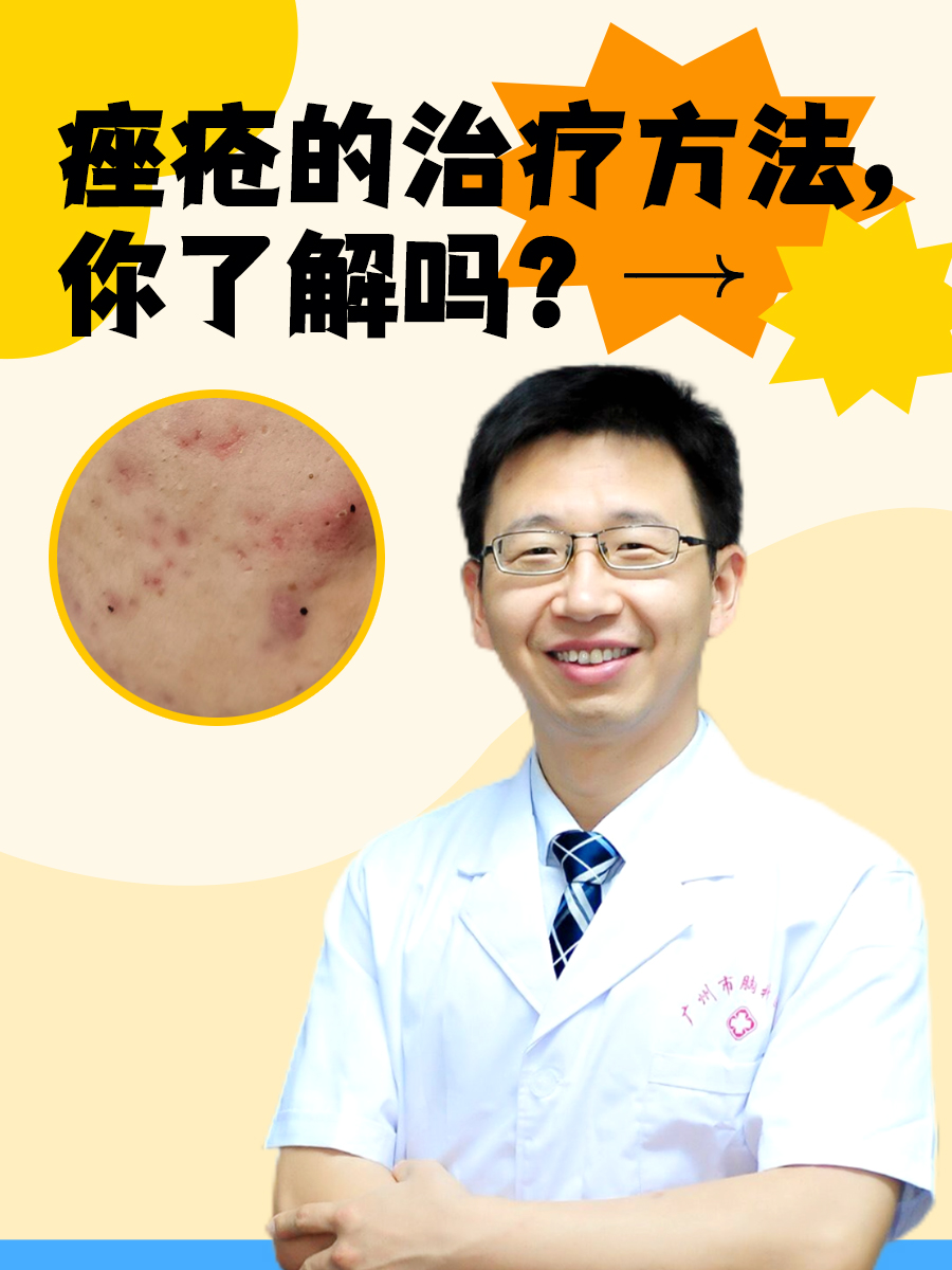 痤疮的治疗方法，你了解吗？
