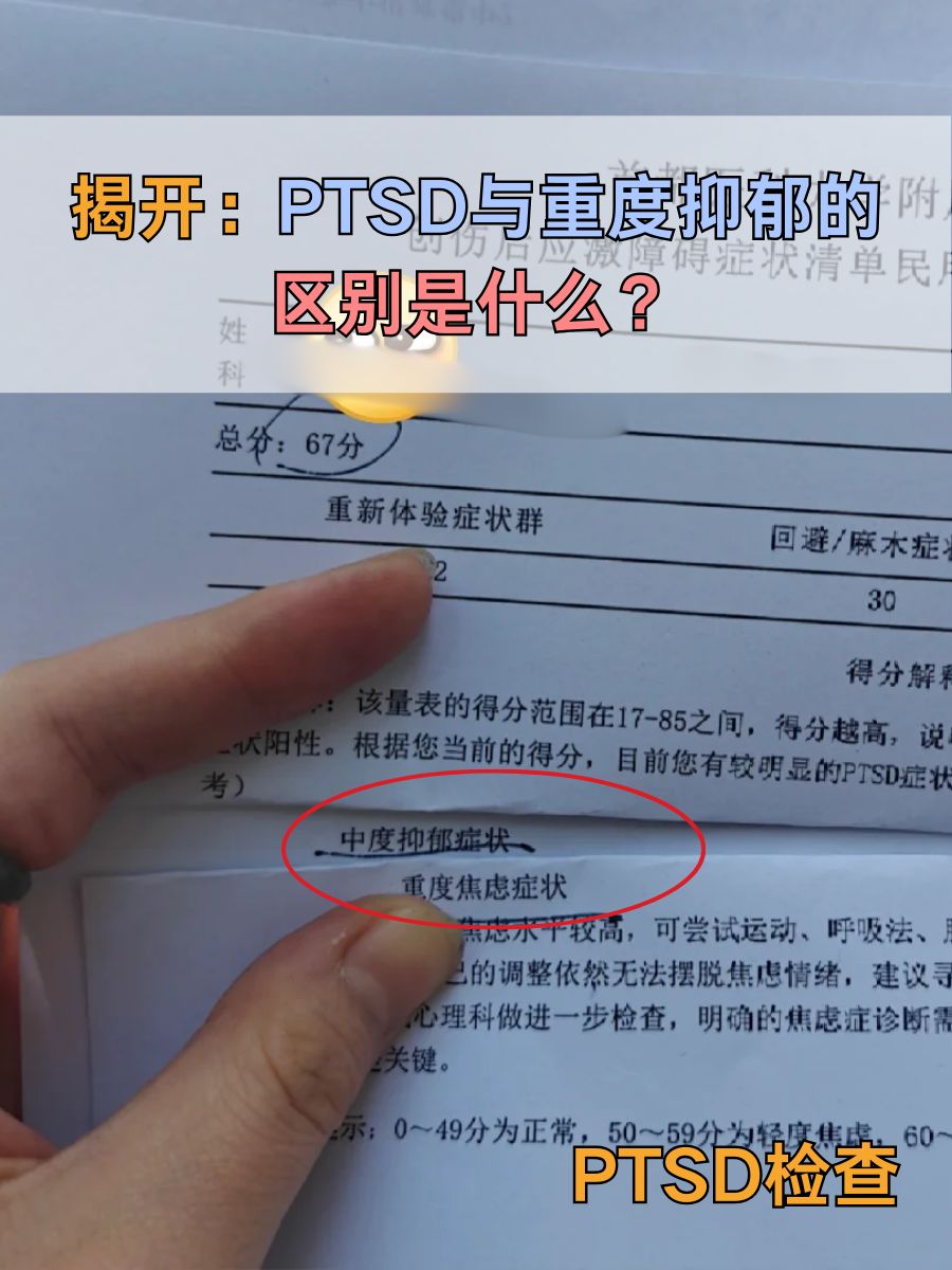 揭开：PTSD与重度抑郁的区别是什么