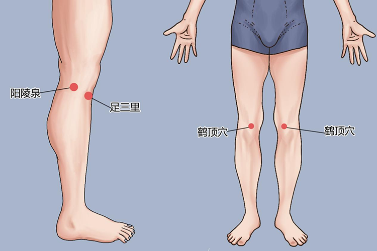 阳陵泉、鹤顶穴位置图 阳陵泉、鹤顶穴位置图