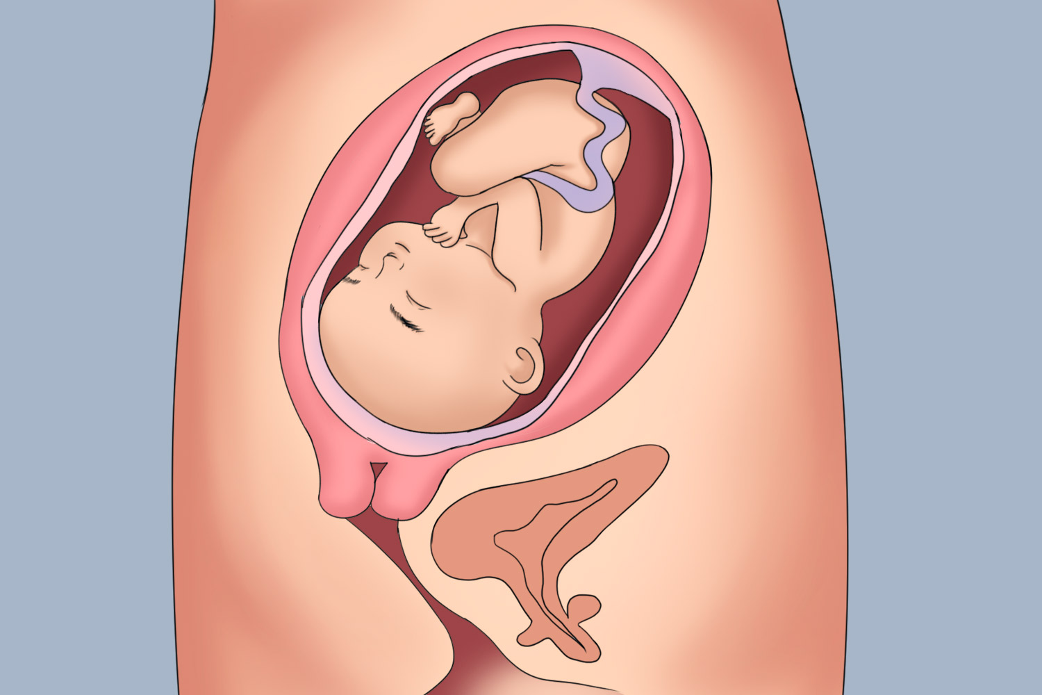 胎儿正常位置图