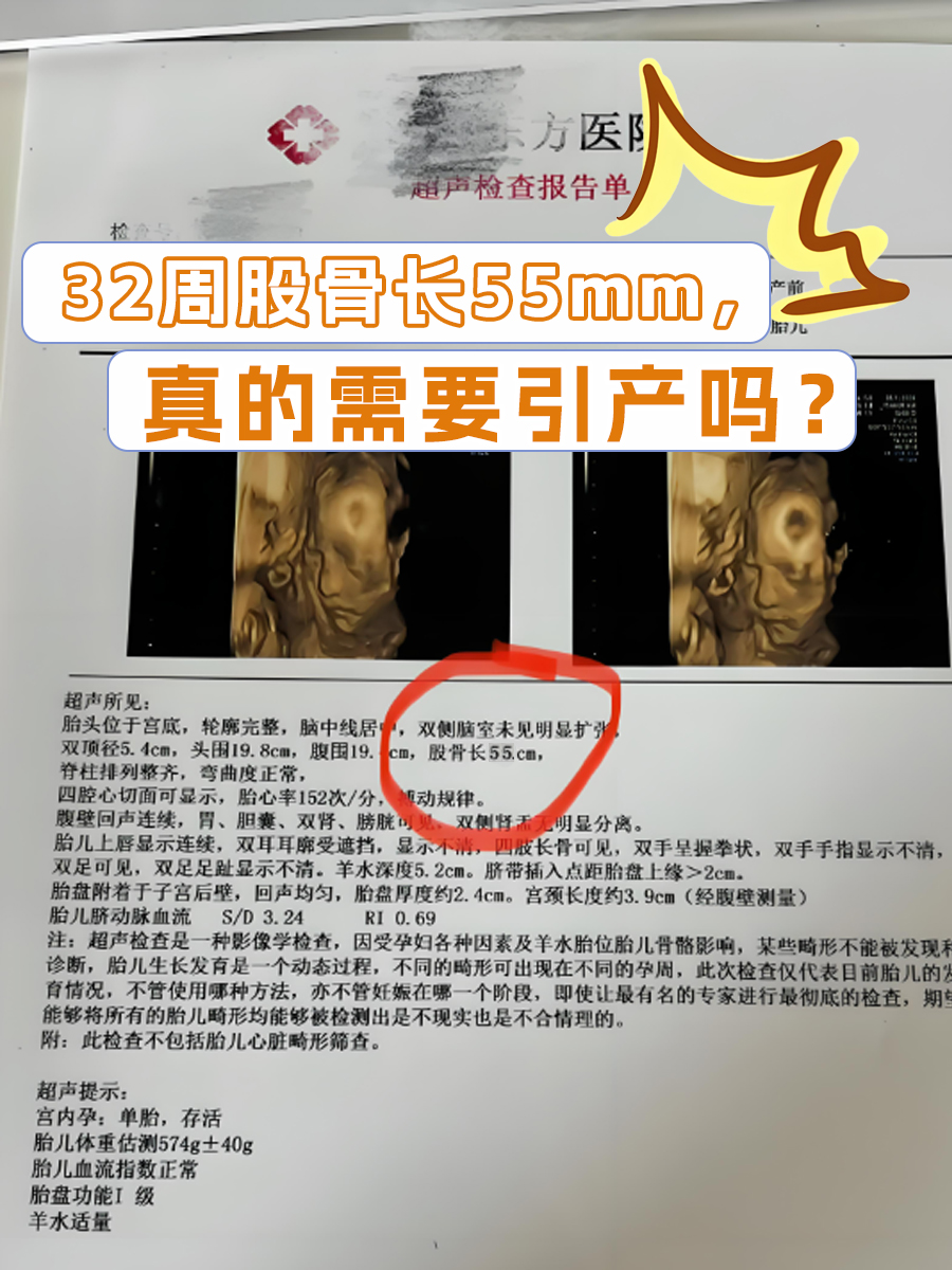 32周股骨长55mm,真的需要引产吗?