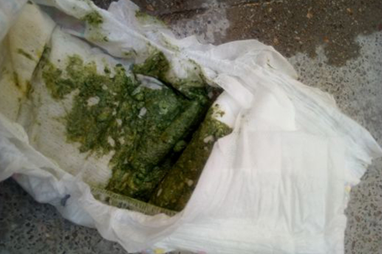 正常绿色大便图