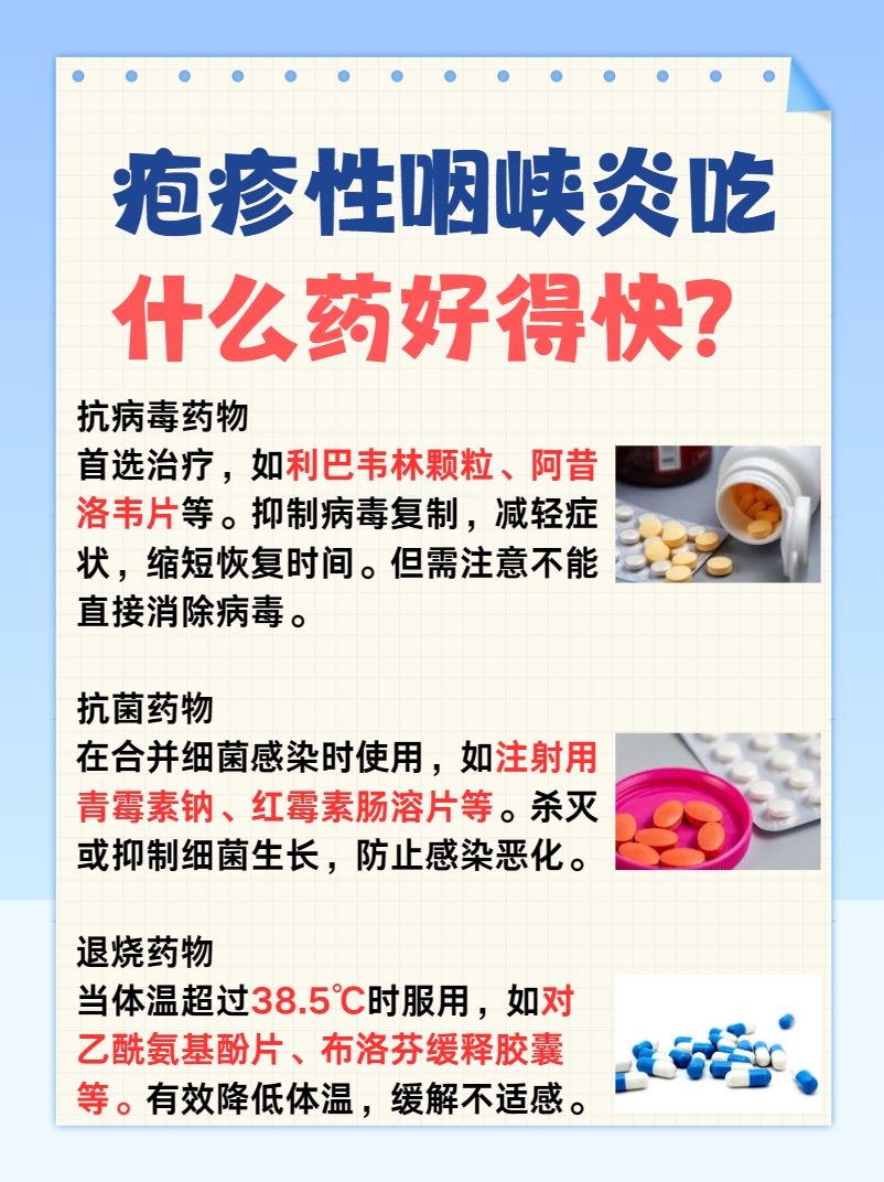 疱疹性咽峡炎吃什么药好得快，一文解析