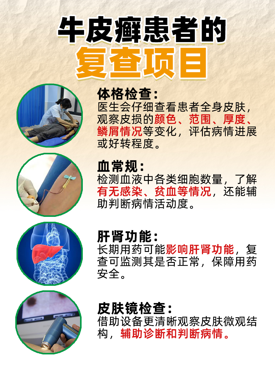 牛皮癣治疗得花多少钱？答案在这！