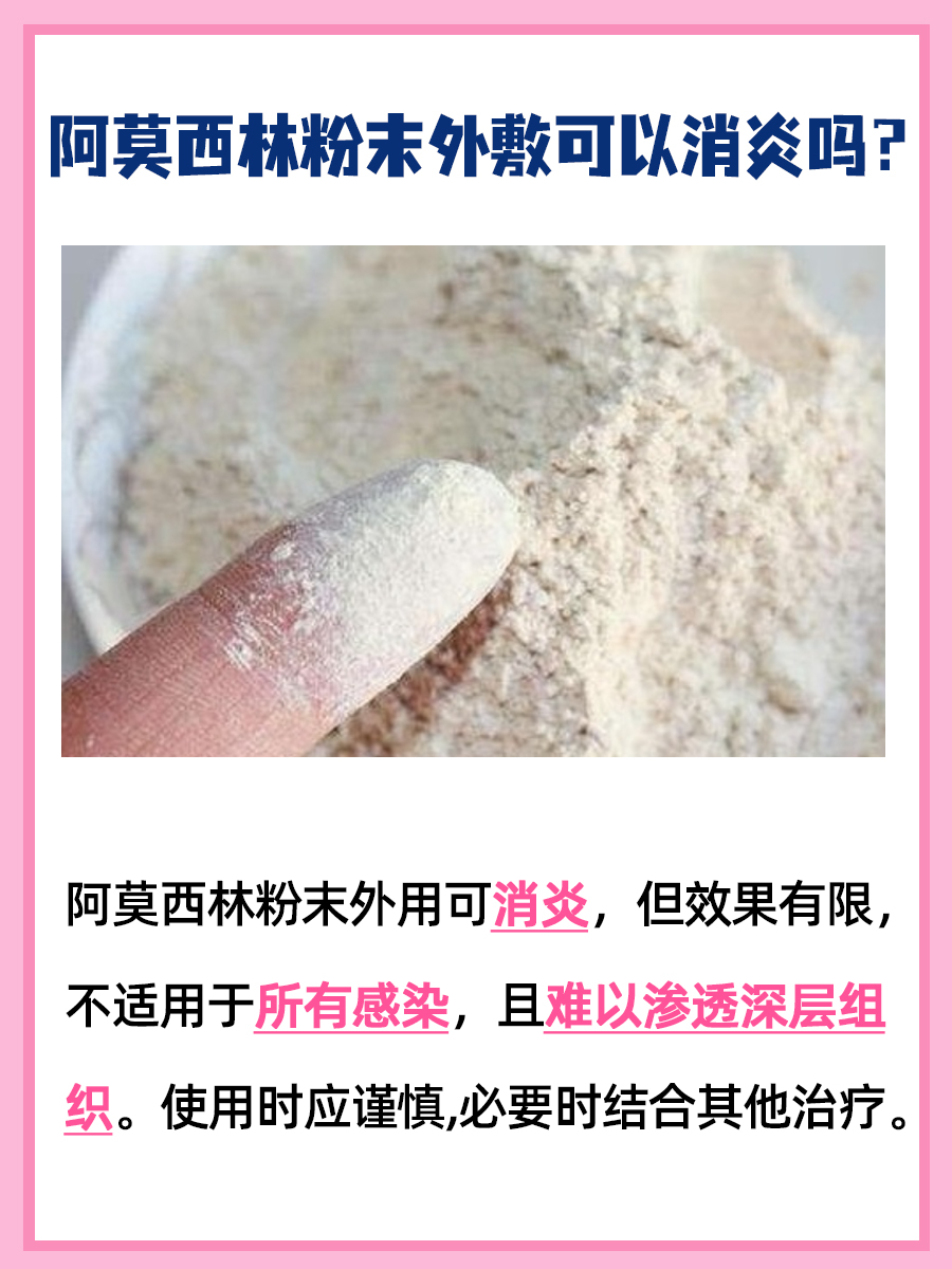 阿莫西林粉末外用消炎？探讨其可能效果