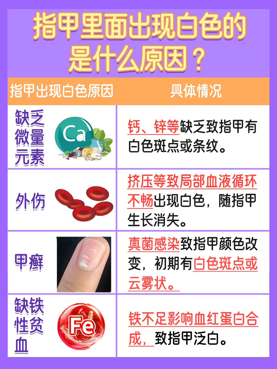 指甲里面出现白色的是什么原因 ？一文解析