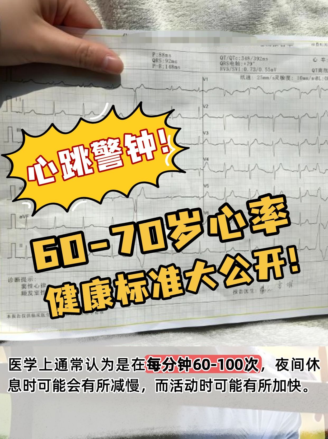 心跳警钟！60-70岁心率健康标准大公开！