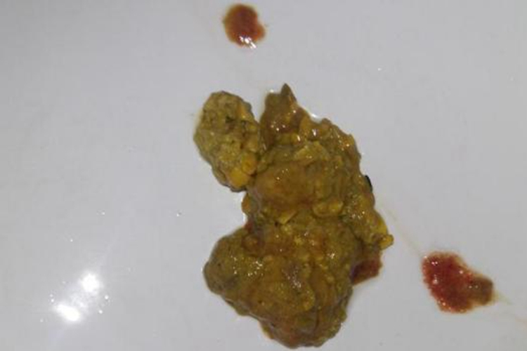 槟榔过敏腹泻症状图