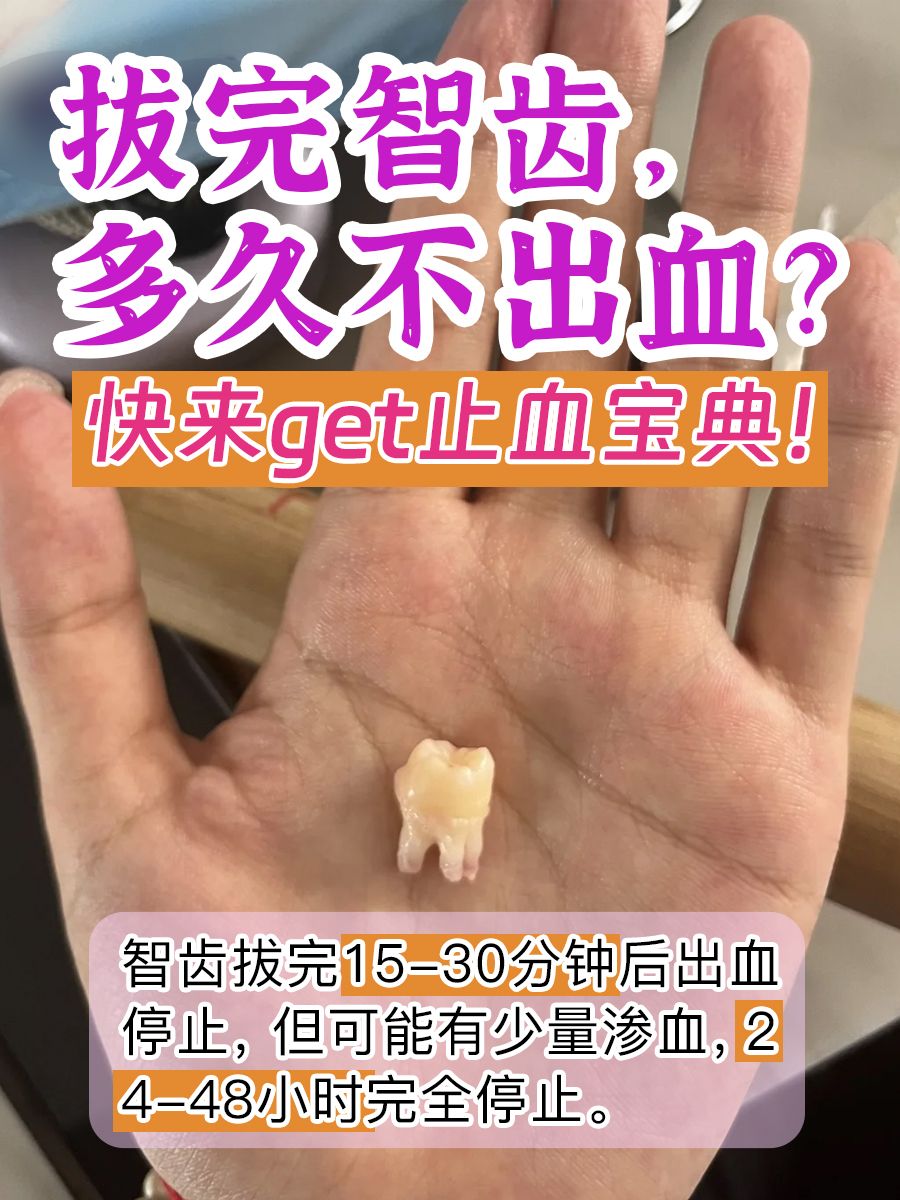 拔完智齿，多久不出血？快来get止血宝典！