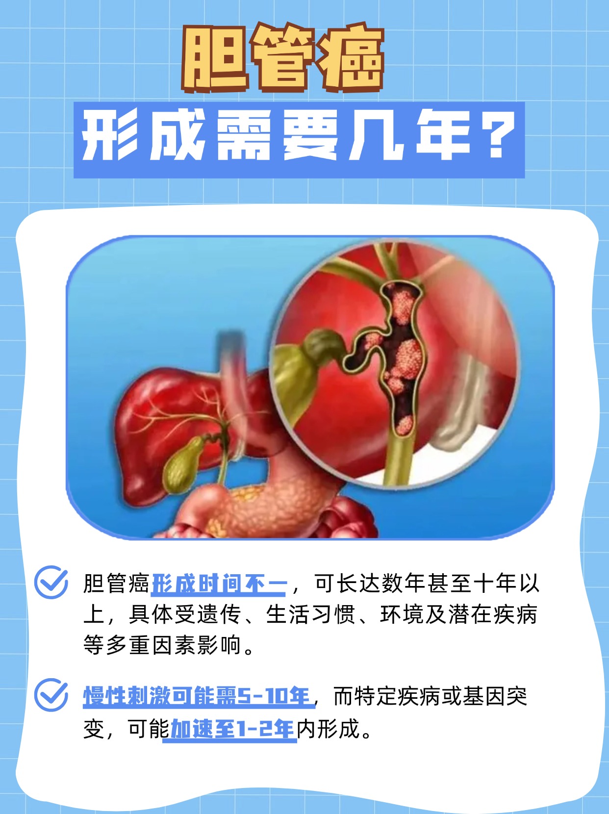 胆管癌形成需要几年，你知道吗？