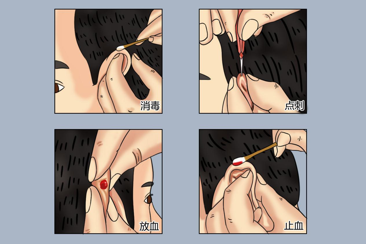放血流程图