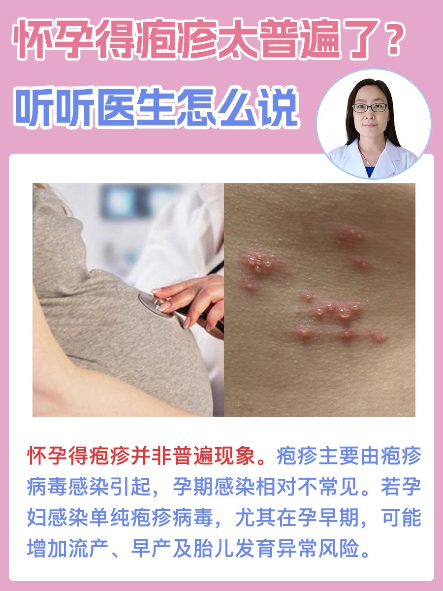 怀孕得疱疹太普遍了？听听医生怎么说
