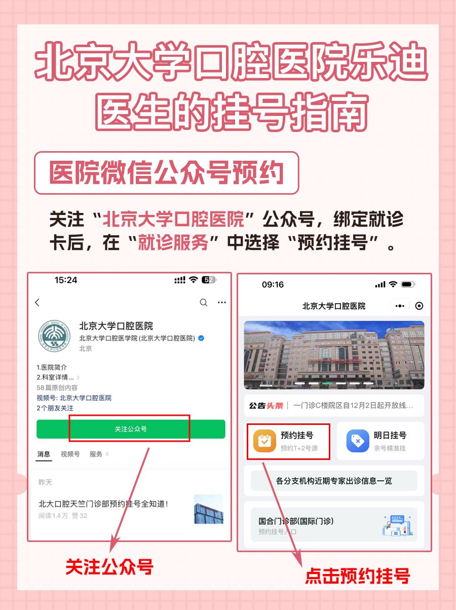 北京大学口腔医院乐迪医生怎么样?怎么挂号?