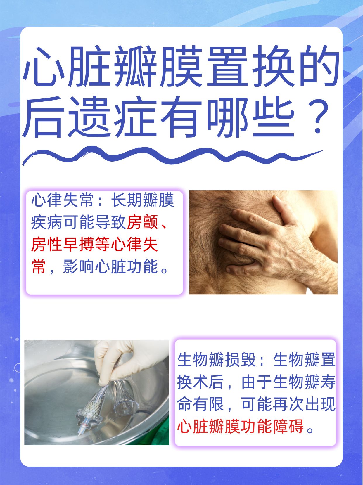 瓣膜置换后，生活能否如初？