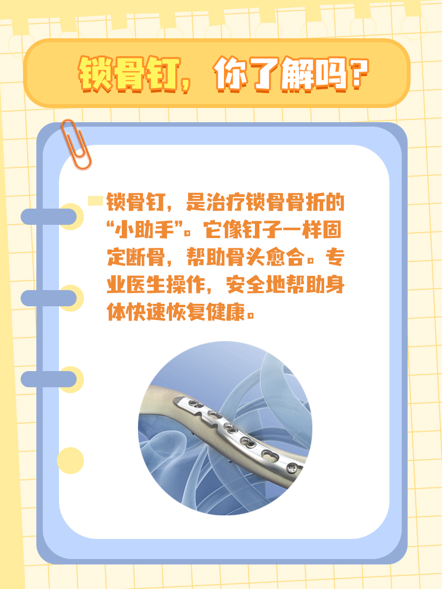 锁骨骨折的内固定器材——锁骨钉，你了解吗？